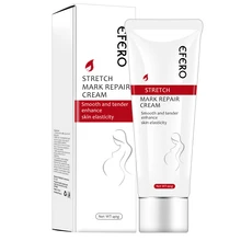 Удаление растяжек крем Ремонт беременность шрамы Материнство укрепляющий Гладкий крем для ухода за кожей против старения морщин лосьон для тела