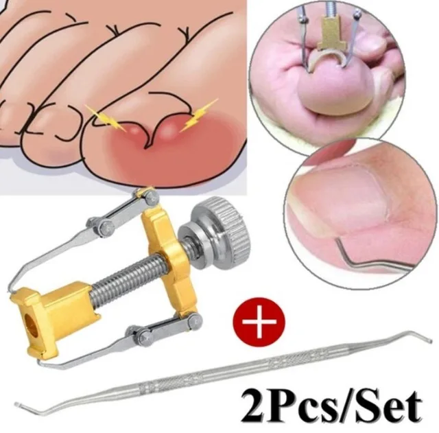 

Foot Care Tool Toe Nails Clippers Ingrown Nail Nippers Cutters Foot File Dead Skin Dirt Remover + Paronychia Podiatry Pedicure