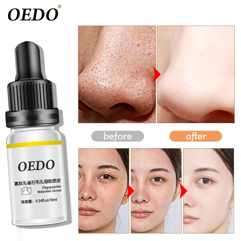 

OEDO oligopeptide malachite shrink fine pores revitalizing skin anti-aging moisturizing facial cleansing care products 10ml