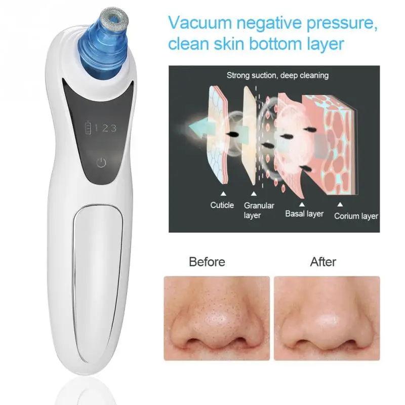 Electric Blackhead Removal Facial Vacuum Pore Cleaner Acne Suction Face