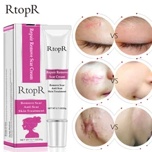 Крем для удаления шрамов от акне, крем для восстановления кожи, крем для лица от акне и пятен, крем против угрей