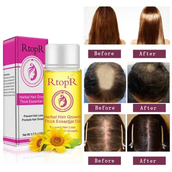 

20ml Herbal Hair Growth dense hair fast hair growth grow essential oil alopecia Treatment