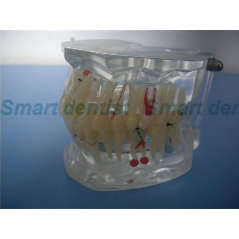 

2016 KQT-K053,Comprehensive pathology crystal dentition model,transparent teeth models