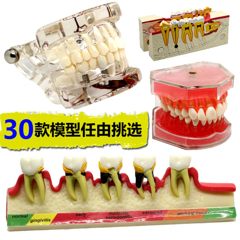 Различные стоматологические модели зубов используются для обучения и больничного стоматологического материала