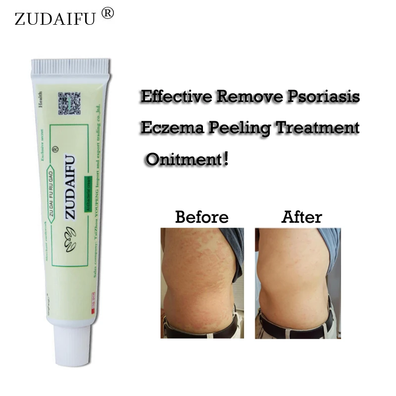 Zudaifu псориаз крем от псориаза мазь дерматит Eczematoid Eczema мазь лечение кожи крем