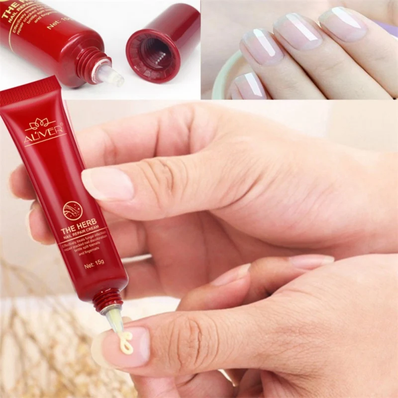 Nail Protection Skin Care Cream Nail Mushroom Treatment Grass Nails Repair Cream Nail Care Tools For Fingernails Toenail