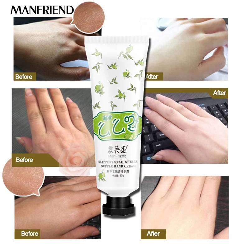 

Snail Serum Repair Hand Cream Nourishing Hand Care Anti Chapping Anti Aging Whitening Firming Hand Cream Skin Care Beauty