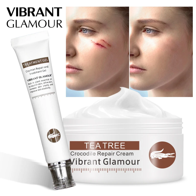 VIBRANT GLAMOUR Crocodile Repair Scar Cream Removal Scar Acne Treatment Marks  Deeply Repairs For Face Or Body  Skin Care Set