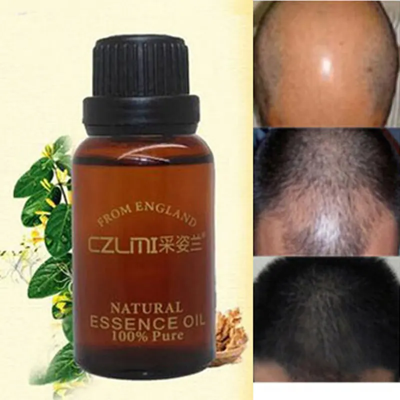 Keratin-treatment-Hair-Loss-Products-Natural-With-No-Side-Effects-Grow-Hair-Faster-Regrowth-Hair-Growth