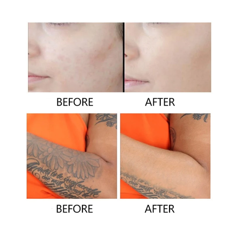 2019 Best Selling Concealer Lasting Oil Control BB Cream Concealer Acne Marks Makeup Tattoo Liquid Foundation Makeup 2019 Best Selling Concealer Lasting Oil Control BB Cream Concealer Acne Marks Makeup Tattoo Liquid Foundation Makeup