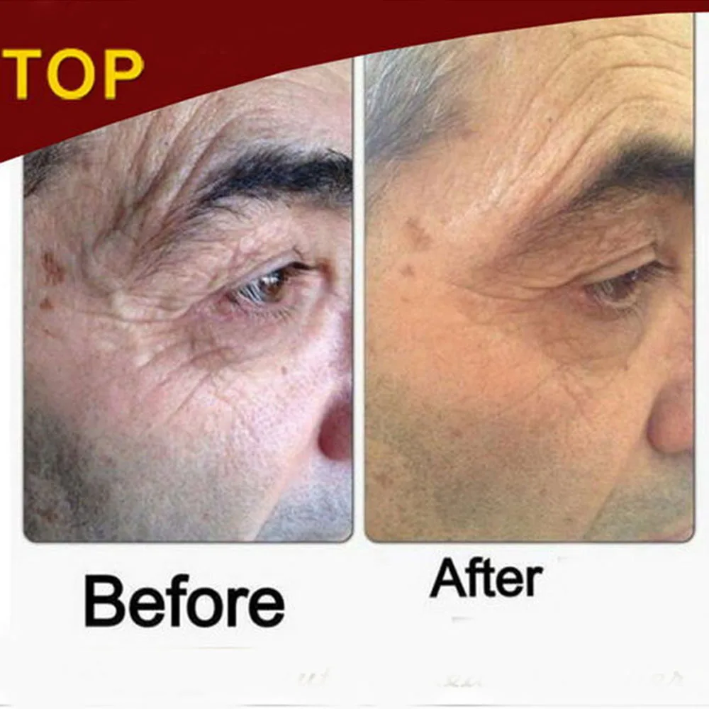 

sachets USA jeunesse Instantly products anti aging anti wrinkle cream argireline face lift serum eye bags remove 50pcs