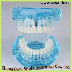 Учебная модель для стоматологов с ортодонтический керамический брекет M3002