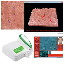 Бренд HD 5MP разрешения кожи лица анализатор/детектор Сфера кожи, жирной, акне, влаги комплексная обнаружения для Красота Hospita
