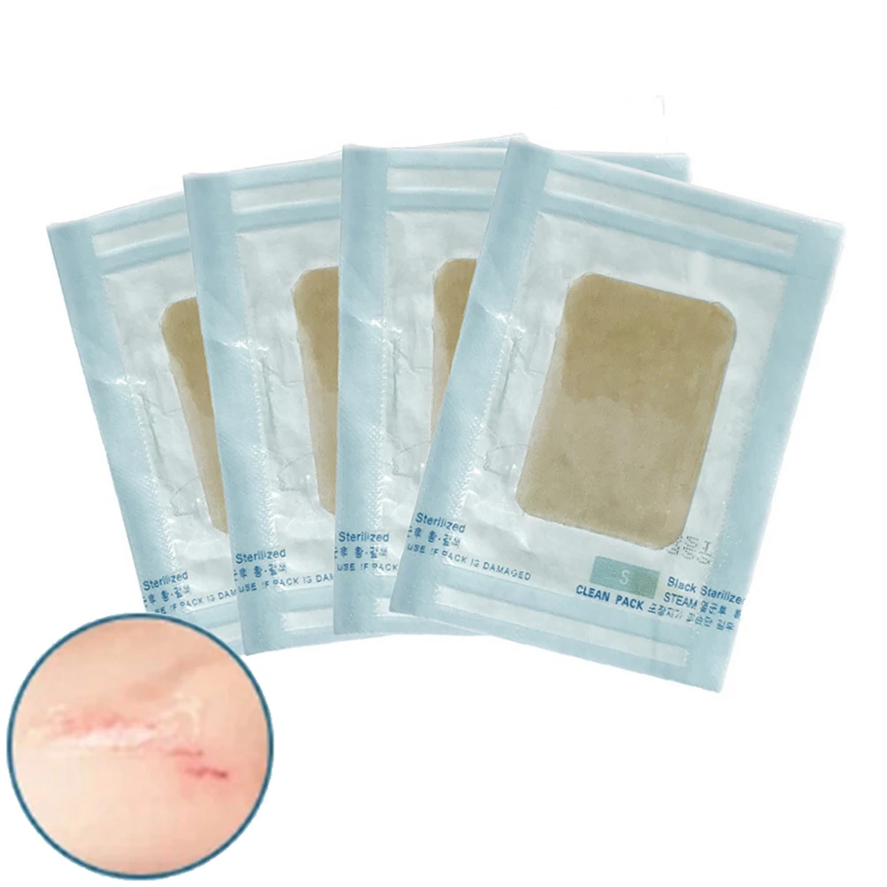 Силиконовый гель для удаления кожных рубцов, цвет кожи, пластырь для удаления чезаревых келоидных шрамов, лист для лечения ран, терапия, 5 см x 3,5 см x 2 мм