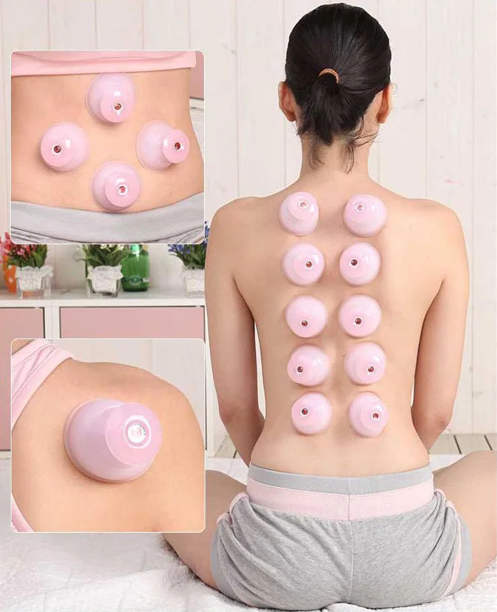 Набор для терапии из натурального силикона 12 чашек бесплатная доставка|cupping