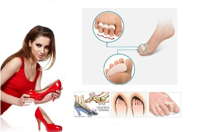 Уход за ногами мягкий кремниевый гель сепаратор гребень для большого пальца ноги для молотка пальцы искаженные ортопедические выпрямления обувь на высоком каблуке коррекция