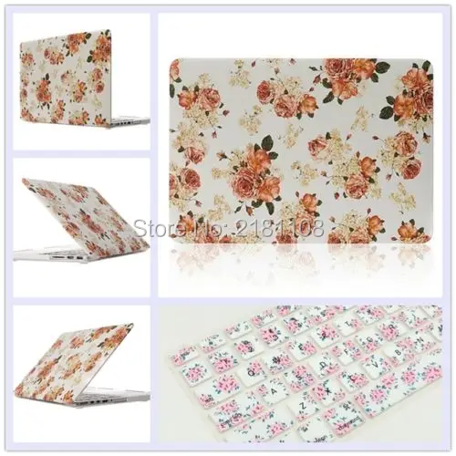 

2in1 Peony Cute Female Rubberized Matt Hard Case Cover for MacBook Air Pro Retina 13" 15"inch A1502 A1466 A1278