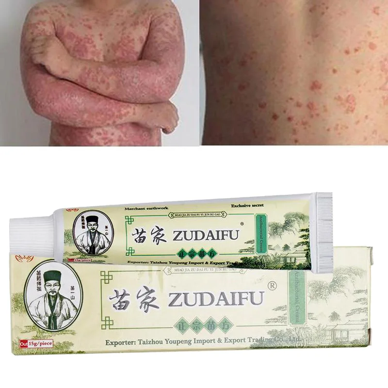 Zudaifu крем для ухода за кожей от псориаза мазь дерматита экзематоидная Eczema Pruritus