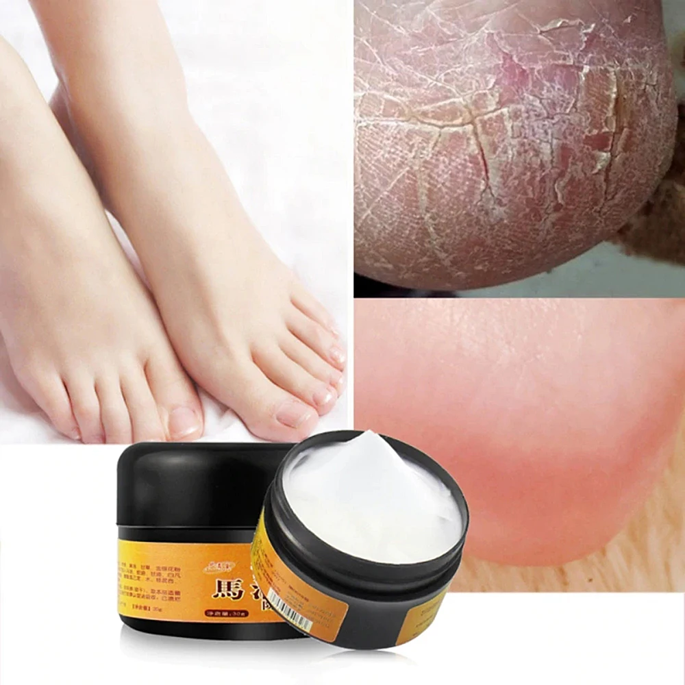 

1pc Horse Oil Feet Cream for Foot Feet Itch Blisters Anti-chapping Prevent cracking Peeling Repair Cream Foot Care TSLM2