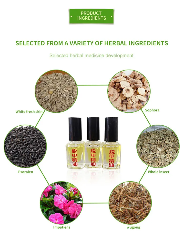 масло чайного дерева от грибка. эфирное масло от грибка ногтей на ногах. масло чайного дерева для ногтей от грибка ногтей. онихолизис масло чайного дерева. масло чайного дерева родники сибири 30мл.