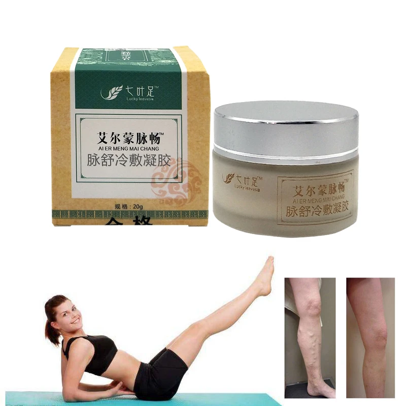 

Varicose Veins Cream Of Varicose Veins Medical Spider Veins Treatment Chinese Herbal Medicine Varicose Veins Ointment 20g