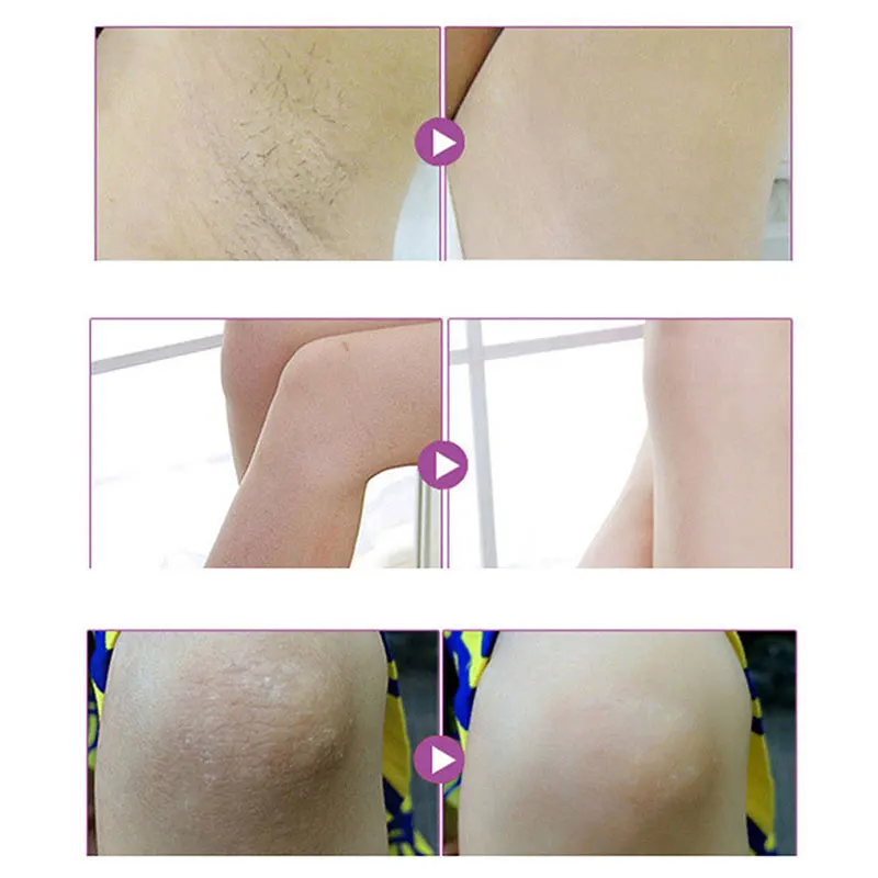 Aichun beauty крем для тела Отбеливание подмышки между ног и коленей отдельные части