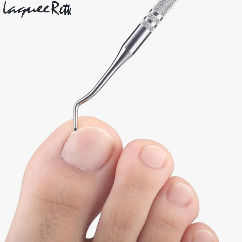 Professional Pedicure Tool Clean Corrector Toe Nail Fixer Correction Foot Nail Care Toe Nail Hook Double Ended Ingrown Toenails Professional Pedicure Tool Clean Corrector Toe Nail Fixer Correction Foot Nail Care Toe Nail Hook Double Ended Ingrown Toenails