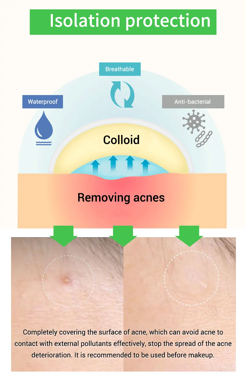 BREYLEE маска для лица сыворотка для лица уход за лицом акне лечебная ...