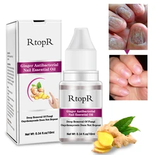 Жидкость для лечения грибковых ногтей, уход за ногами, отбеливающая эссенция, гель для удаления грибков на ногах, против инфекции, парониксия, онихомикоз