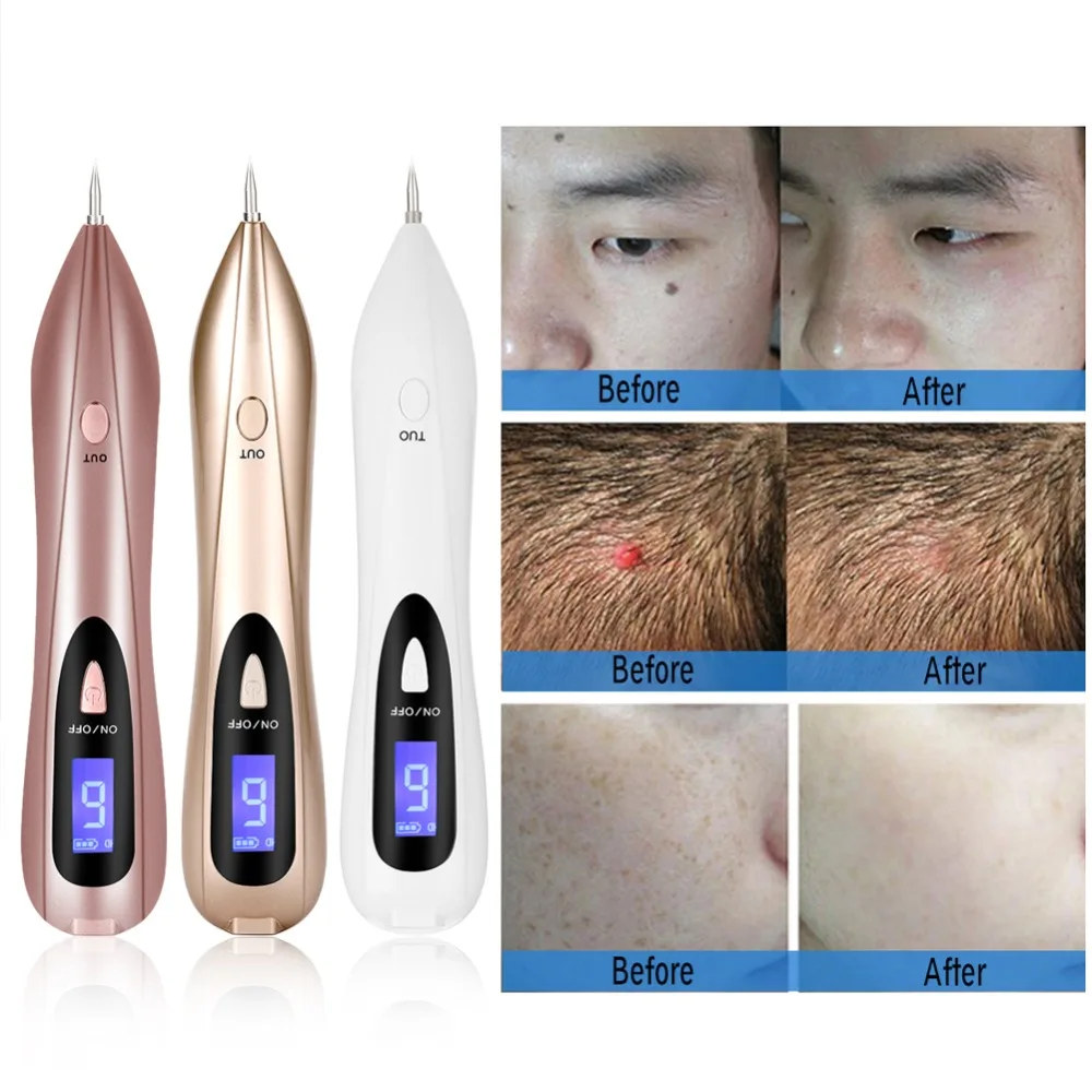 

Portable LCD Spot Tattoo Freckle Removal Machine No Bleeding Mole Dot Removing Laser Plasma Pen Pore Cleaner Blackhead Face Acne