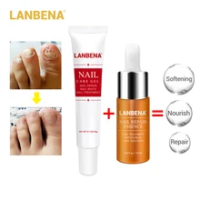 LANBENA, 2 шт., средство для лечения грибка ногтей, набор, гель для ухода за ногтями+ восстанавливающая эссенция, удаляет онихомикоз, ноготь, питает рост