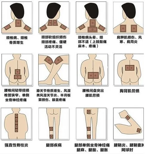 2015