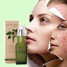 40 г апельсиновый цвет отбеливающая эссенция удаляет акне уход за чувствительной кожей увлажняющая эссенция