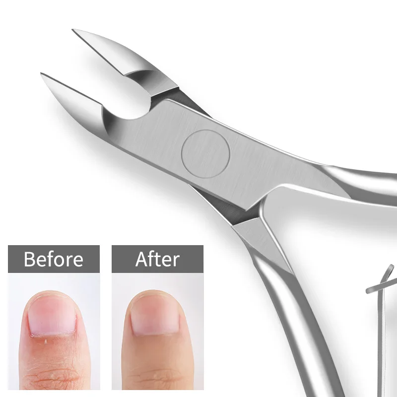 Nail Clipper Set Nail Clipper Toe Nail Clipper Nail Scissors Set Nail Clippers Manicure Set 1pcs Sliver Gold Nail Clipper Dead Skin Cuticle Remover Nail Trimmer Scissor Pliers Stainless Steel