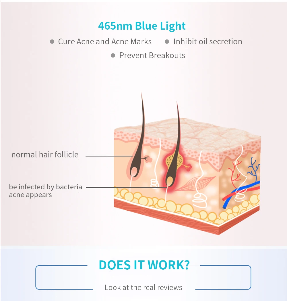 Acne Light Therapy, Xpreen беспроводной Перезаряжаемый Свет устройство ...
