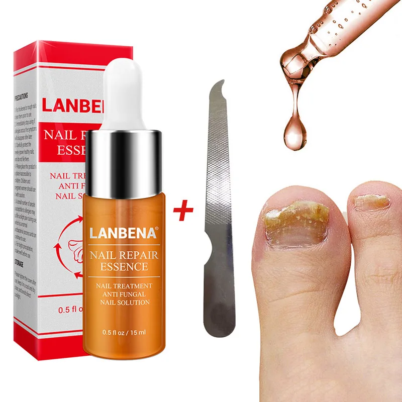 15ml Effective Nail Fungal Treatment Essence Liquid With File Anti Fungus Onychomycosis Removal Nails Care Repair Liquid