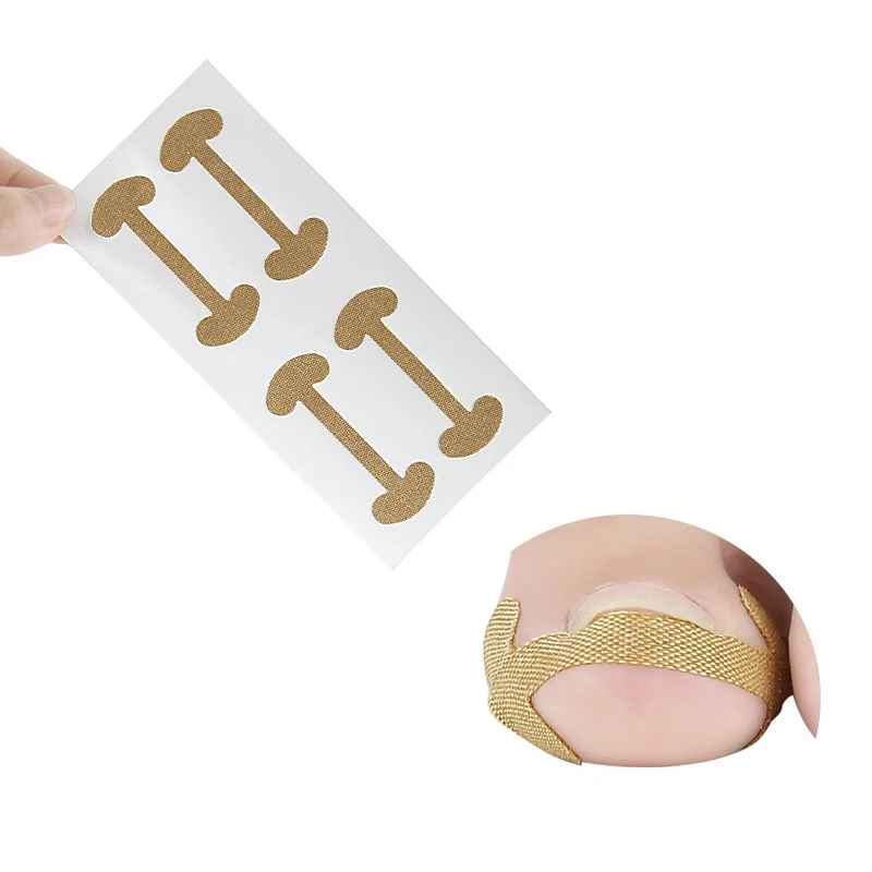 8 Pieces of Nail Corrector For Toe Decals Paronychia Treatment Recover Corrector Pedicure Tools HB88 8 Pieces of Nail Corrector For Toe Decals Paronychia Treatment Recover Corrector Pedicure Tools HB88