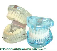 Россыпи натуральных модель головы и шеи(HH) зубной зуб зубы стоматолог стоматология анатомическая Анатомия Стоматологическая модель