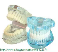 Free Shipping Natural size model (HH) dental tooth teeth dentist dentistry anatomical anatomy model odontologia Free Shipping Natural size model (HH) dental tooth teeth dentist dentistry anatomical anatomy model odontologia