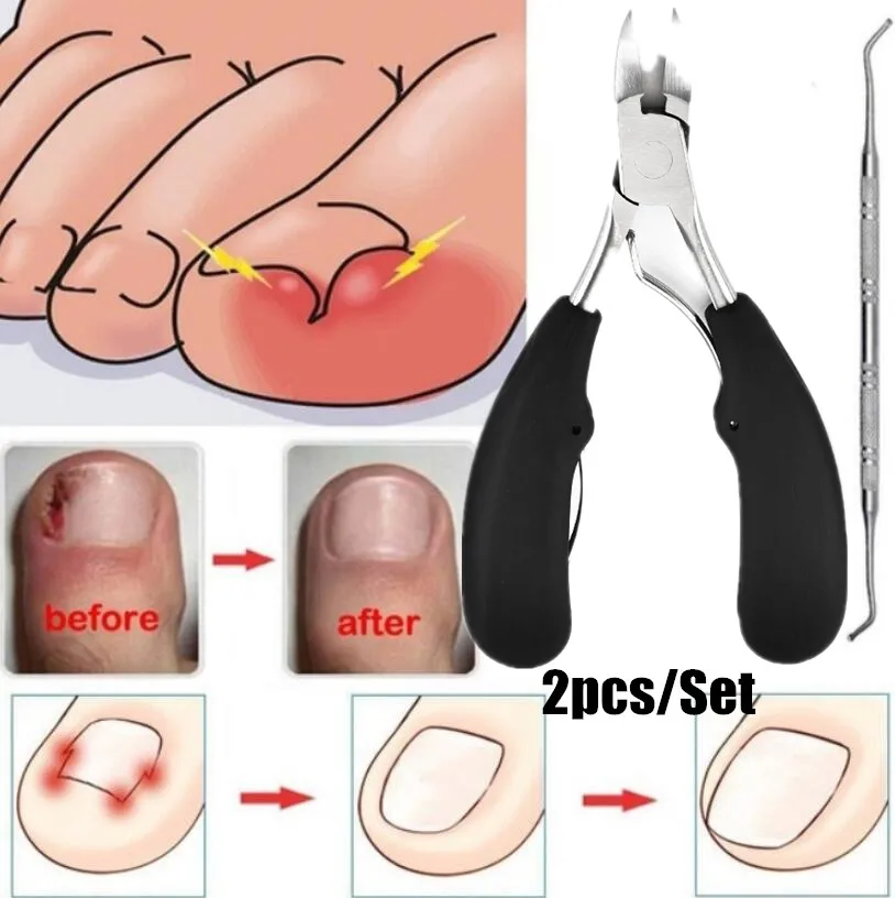 

Toe Nail Clippers Toenail Treatment Nail Correction Nippers Clipper Cutters Dead Skin Remover Podiatry Pedicure Foot Care Tool