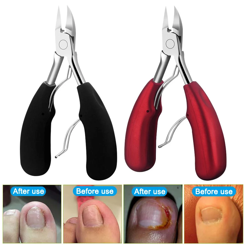 

4 Color Stainless Steel Toenail Clippers Ingrown Toe Nails Clipper Scissors Cutter Manicure Pedicure Dead Skin Remover Pliers