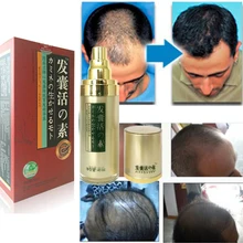 Sunburst Andrea ускоренный рост волос лосьон для роста волос масло человеческих волос Мужская Женская облысение алопеция от выпадения волос продукты