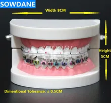 Dental Orthodontic Treatment Model With Ortho Metal Ceramic Bracket Arch Wire Buccal Tube Ligature Ties dental implants inmediate loading full arch new concepts