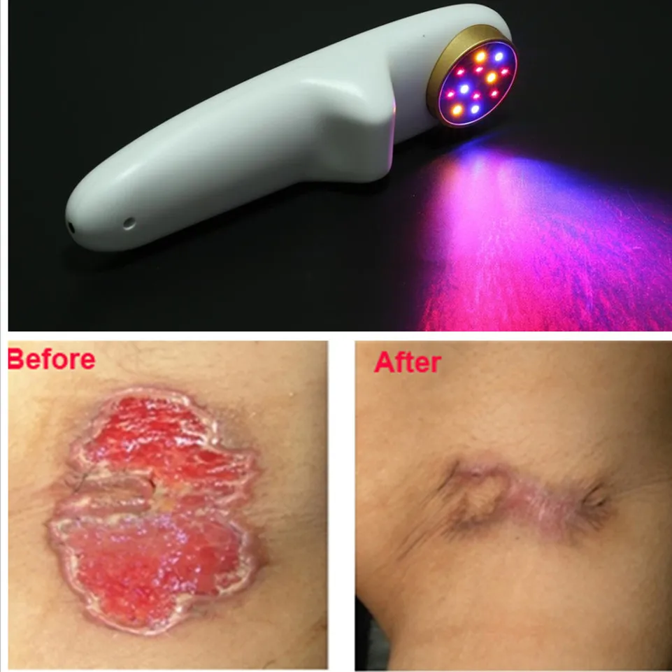 

ATANG RoHs ISO Certificate and Pain Relief Cold Laser Treatment Instrument Product name cold laser therapy machine