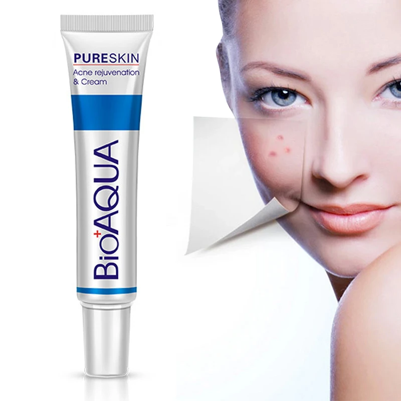 

Face Emulsion 30g Acne Treatment Blackhead Remova Anti Acne Cream Oil Control Shrink Pores Acne Scar Remove Face Care Whitening