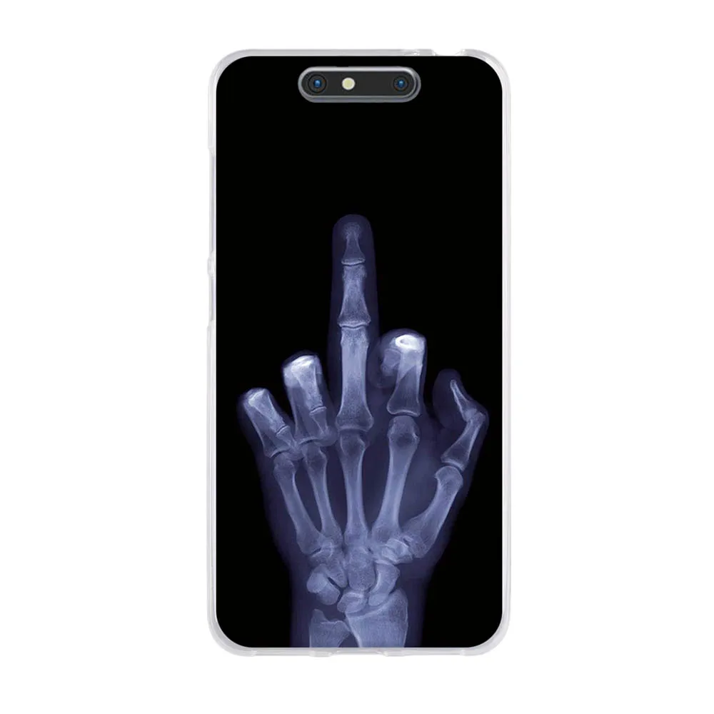 Мягкий чехол из ТПУ для ZTE Blade V8 5 2 дюйма рельефный 3D с рисунком защитный задней