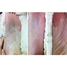 5Pair=10Pcs Baby Feet Skin Smooth Exfoliating Foot Mask Foot Care Mask Foot Care Health Care Pedicure Socks Sosu Peeling Foot