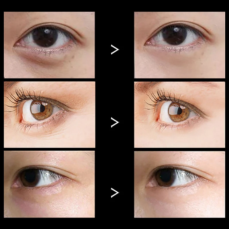 IE0009700-detail (2)