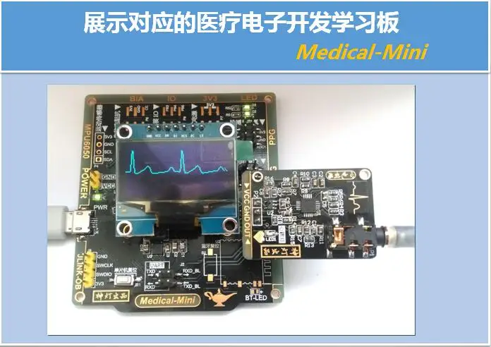 analog front end of ecg Bioelectric signal analog front electrocardiograph front end for sensitive high (ecg) analog -aliasing, -to-two. analog front end of ecg Bioelectric signal analog front electrocardiograph front end for sensitive high (ecg) analog -aliasing, -to-two.