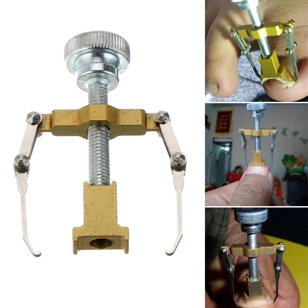 

Professional Ingrown Toenail Pedicure Foot Nail Care File Pedicure Orthotic Hook Toes Ingrown Bunion Corrector Practical Tools